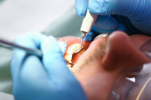 Best Emergency Dental Care for Abscessed Tooth in Ensley, FL